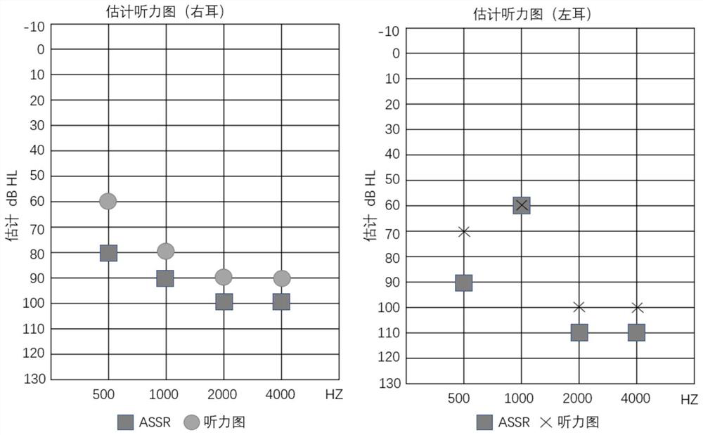 MYO15A gene mutant and application thereof