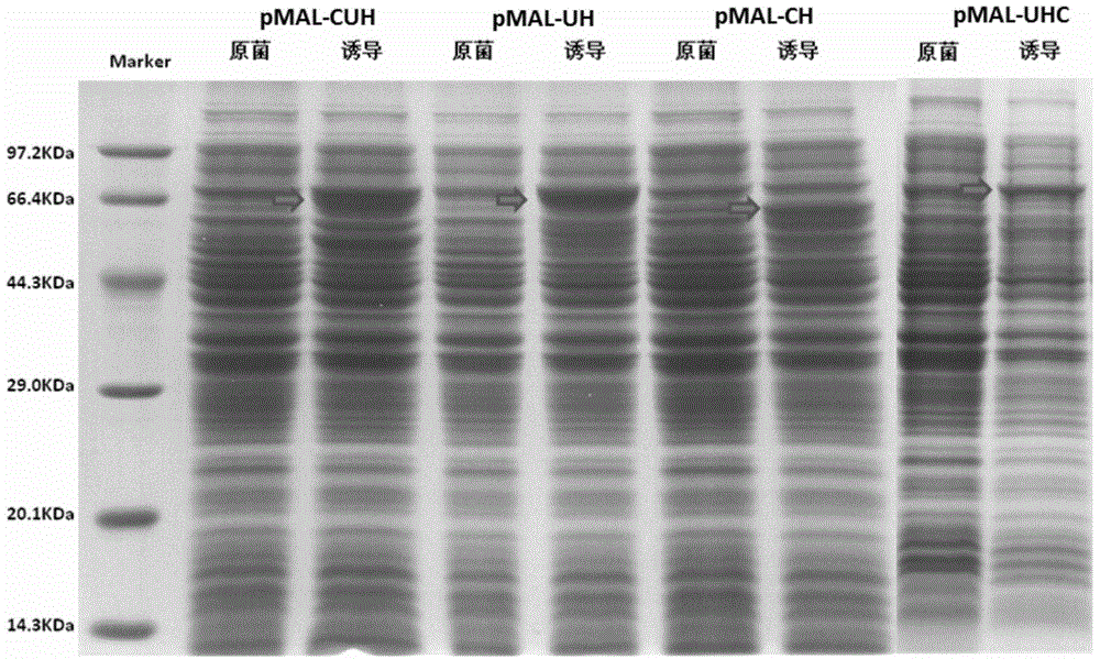 Fusion protein related to HBV, preparing method thereof and application thereof