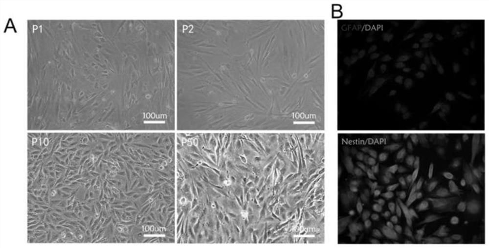 Human glioblastoma cell line GWH04 as well as culture method and application thereof