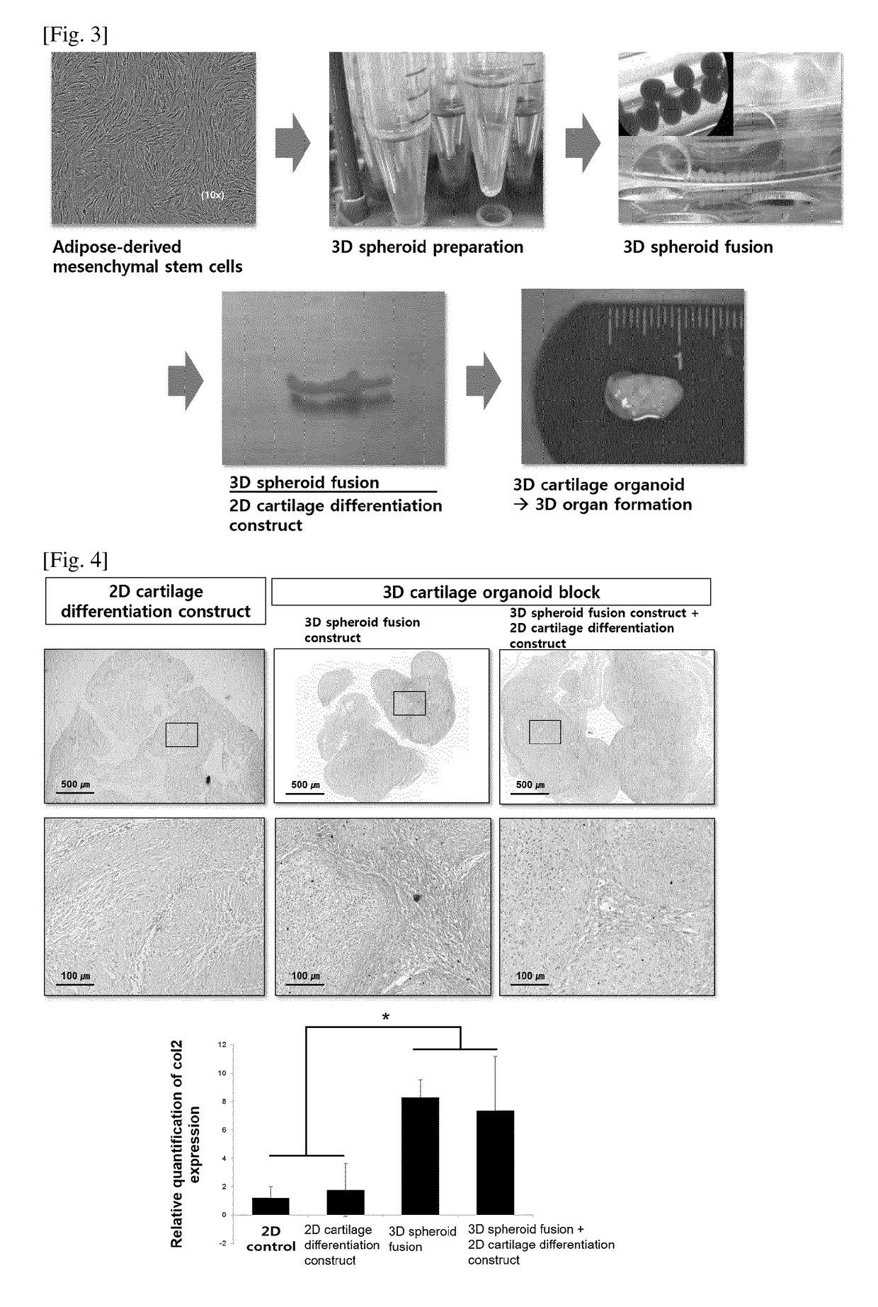 Method for preparing 3D cartilage organoid block