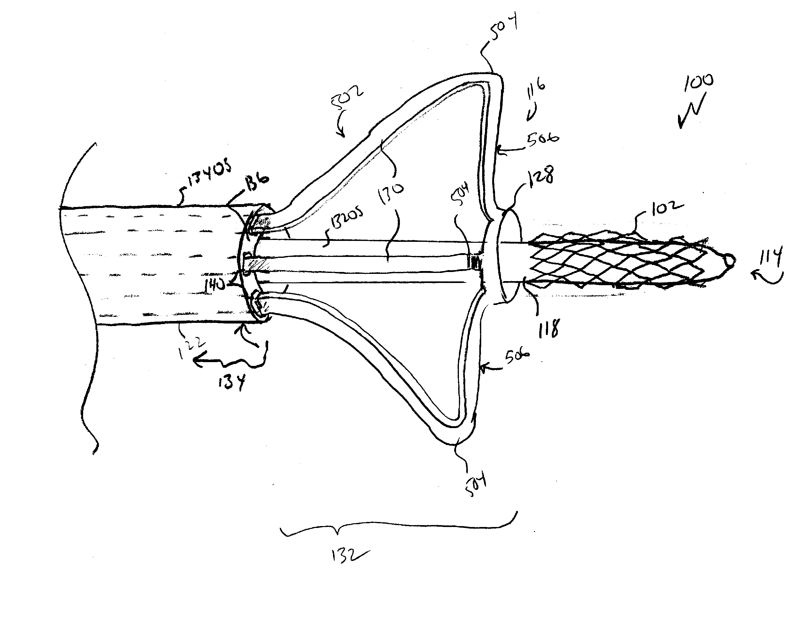 A Mechanism to Ensure Placement of Ostial Renal Stents