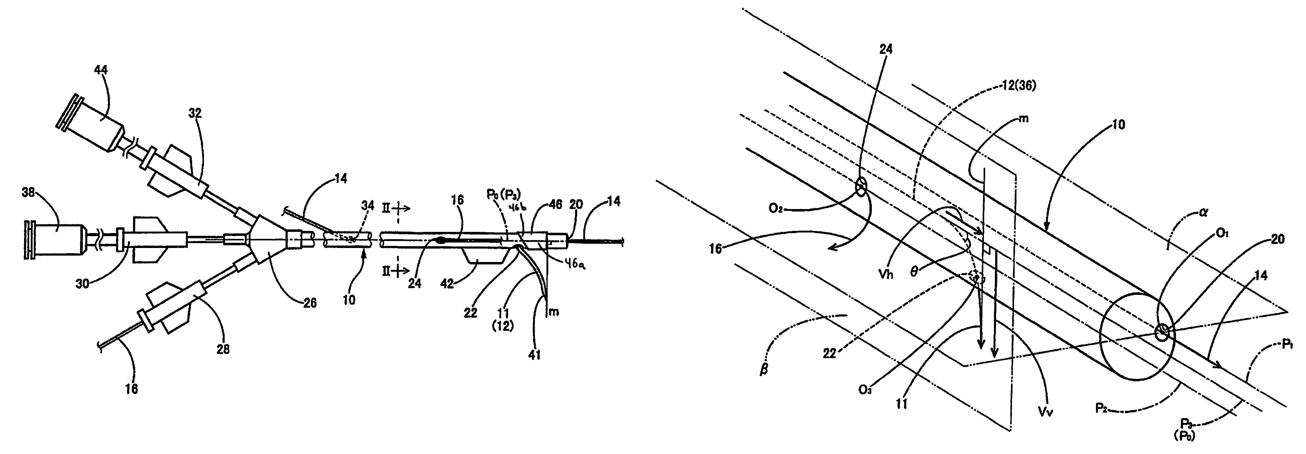 Reagent injection device