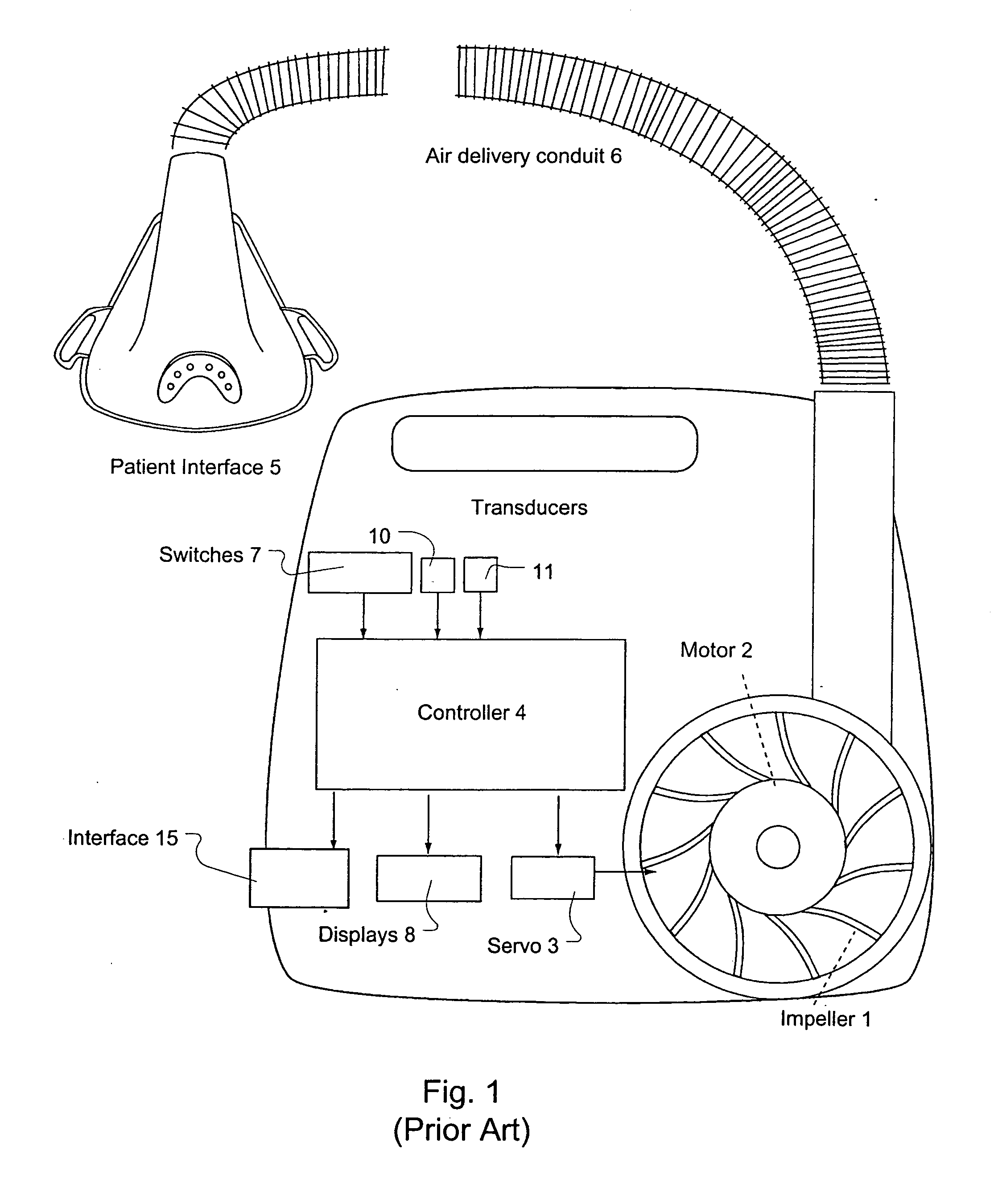 Ventilator patient synchronization