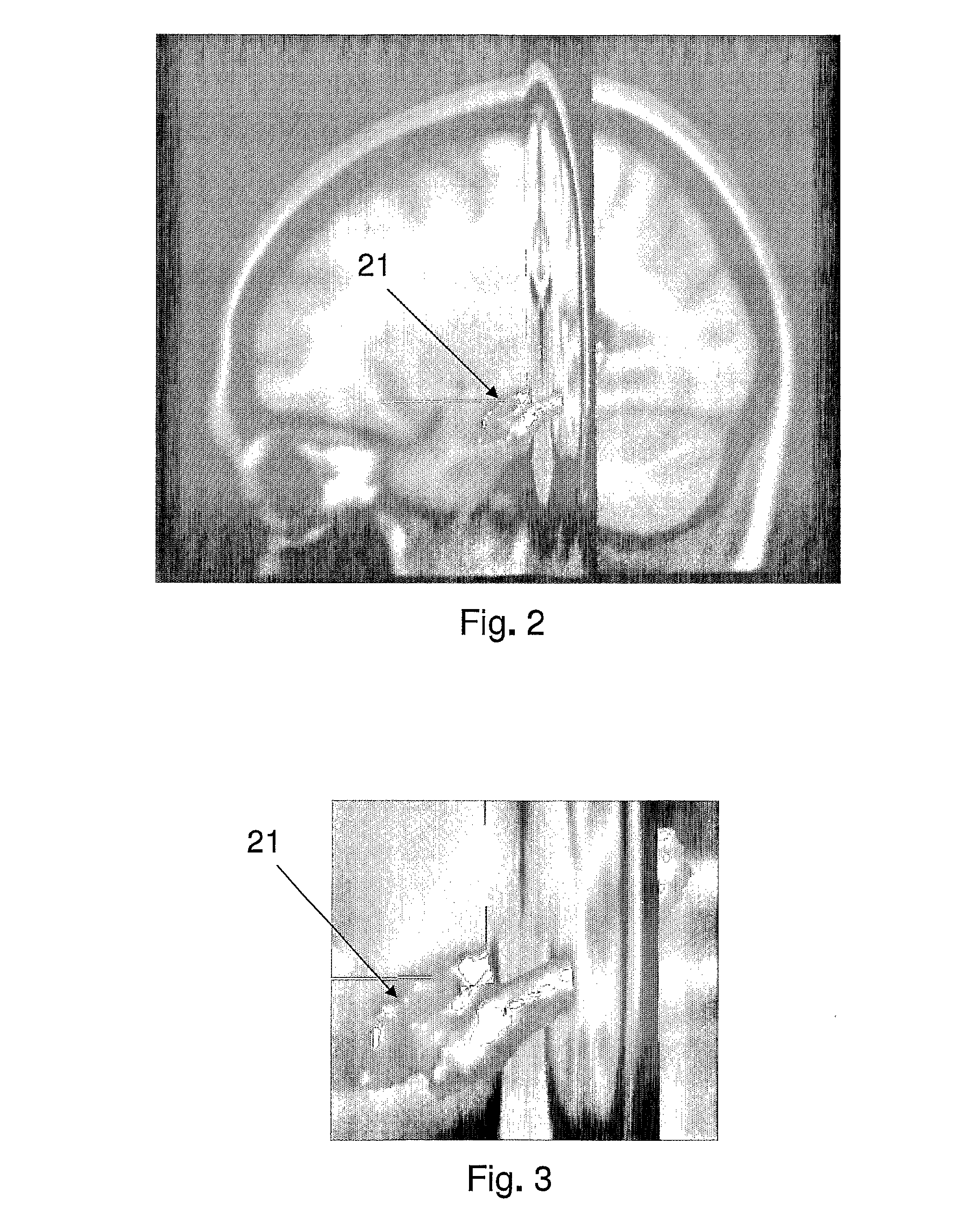 System and method for volumetric analysis of medical images