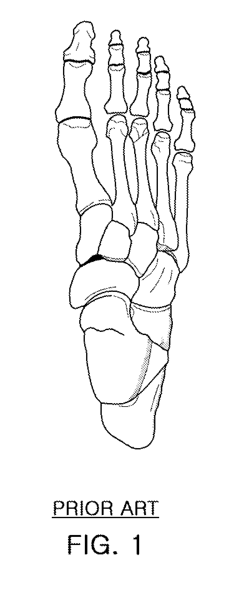 Method and apparatus for analyzing gait pattern