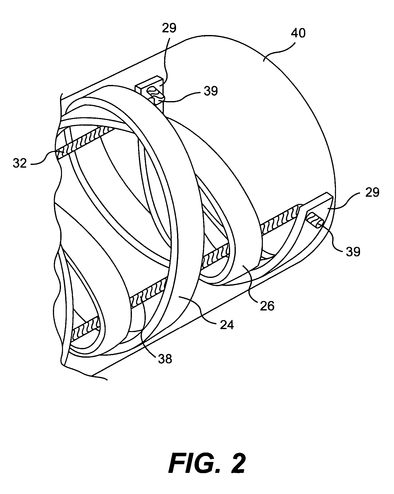 Access catheter having dilation capability and related methods