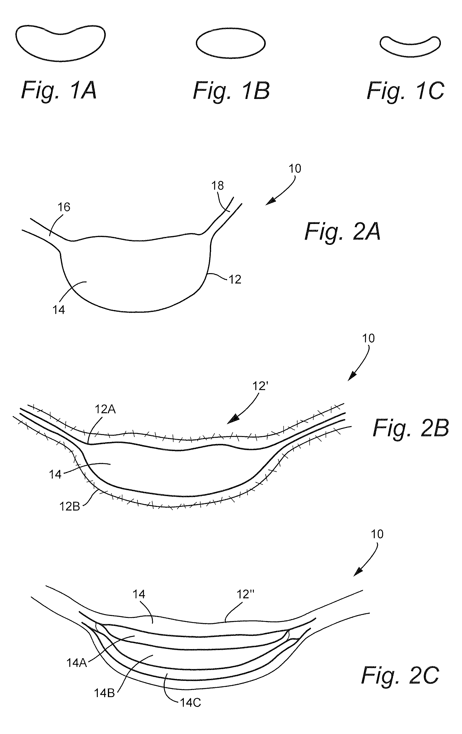 Transpedicular, extrapedicular and transcorporeal partial disc replacement