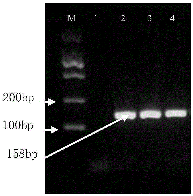 Real-time fluorescence quantification PCR detecting kit for cow mycoplasma and special primers and TaqMan probe thereof