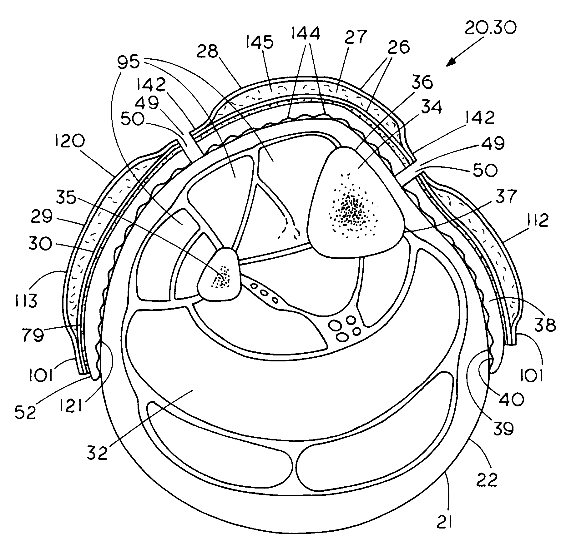 Shin-guard, helmet, and articles of protective equipment including light cure material