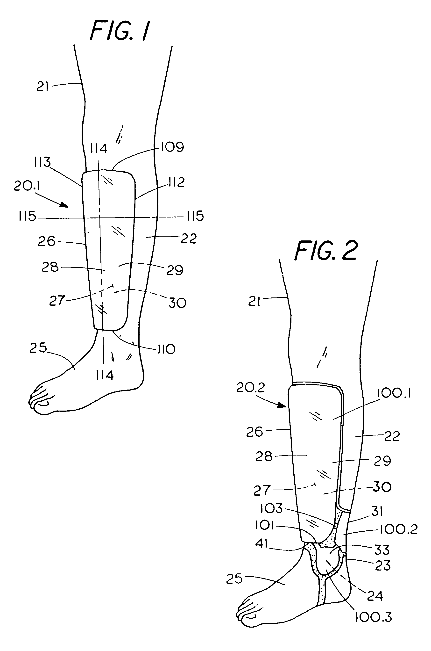 Shin-guard, helmet, and articles of protective equipment including light cure material