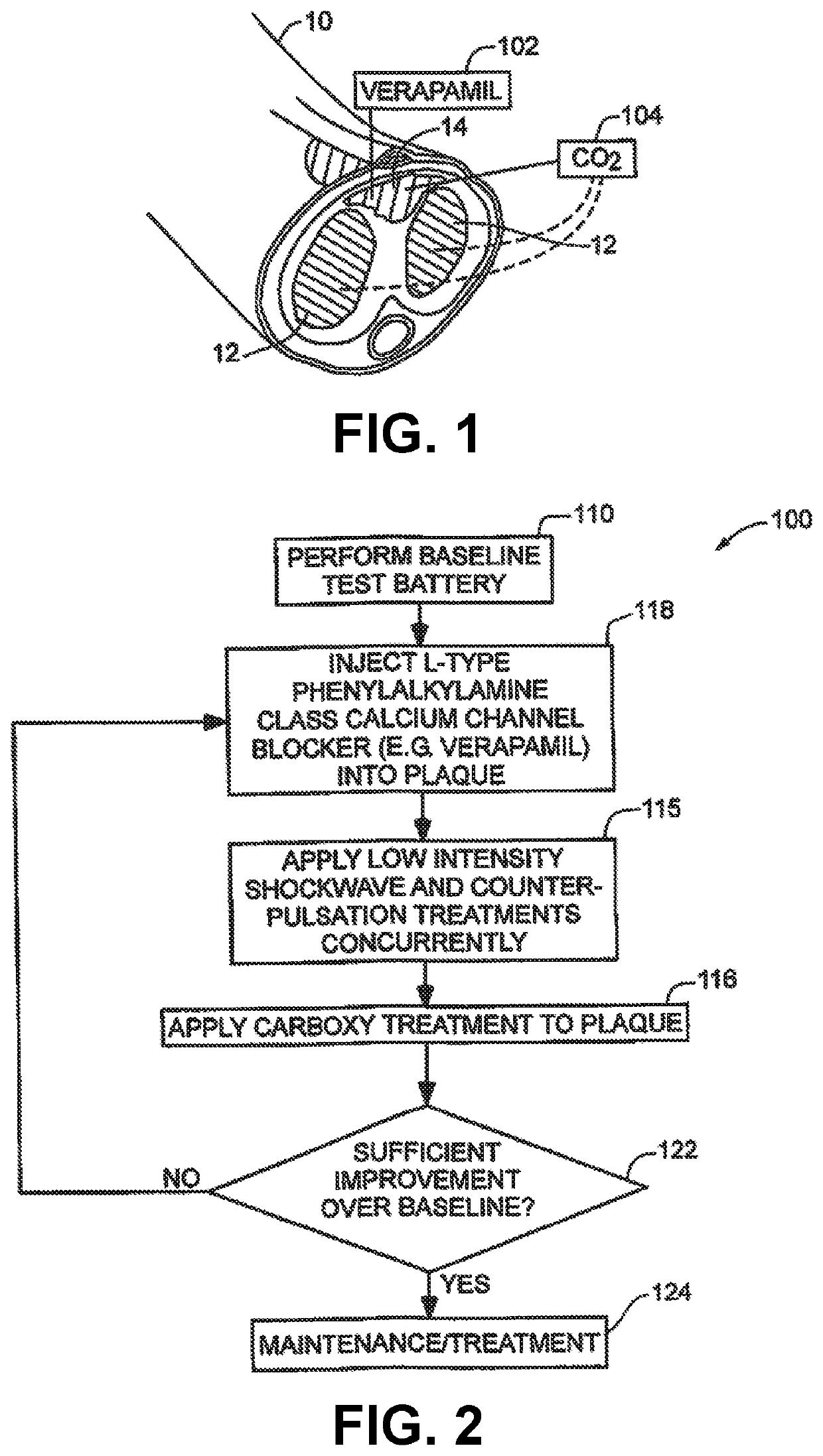 Method for stimulating blood flow in a penile region of a patient