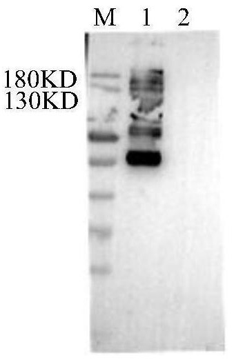 Anti-Shroom2 autoantibody for detecting autoimmune system diseases as well as product and application thereof