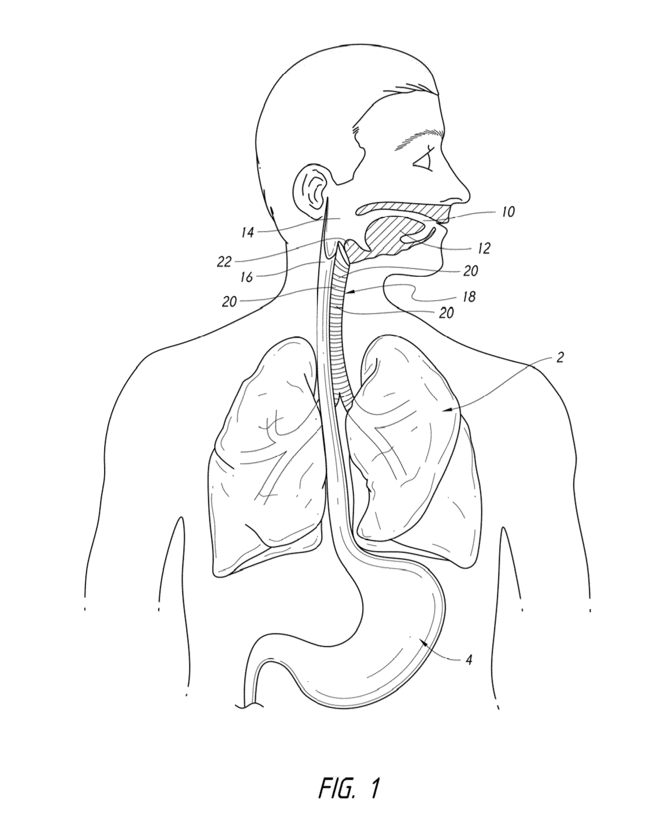 Apparatus and method for improved assisted ventilation