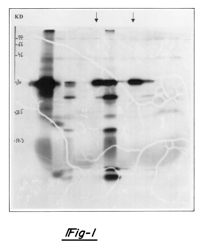 Hypoxia-regulated genes