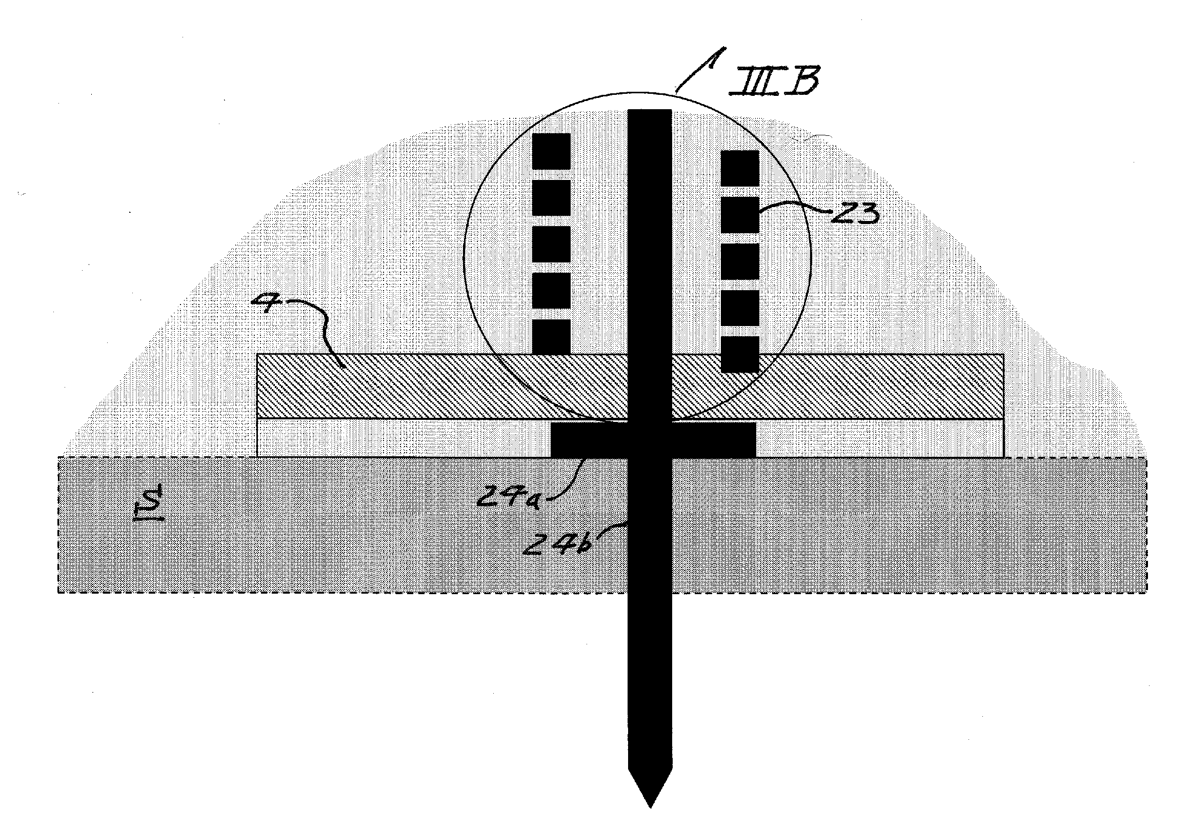 Apparatus for Neurostimulation