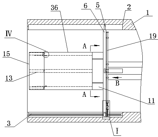 Stone removal device for hepatobiliary surgery clinics