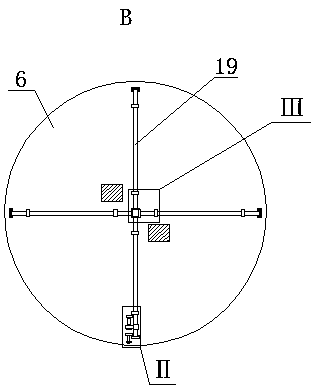 Stone removal device for hepatobiliary surgery clinics