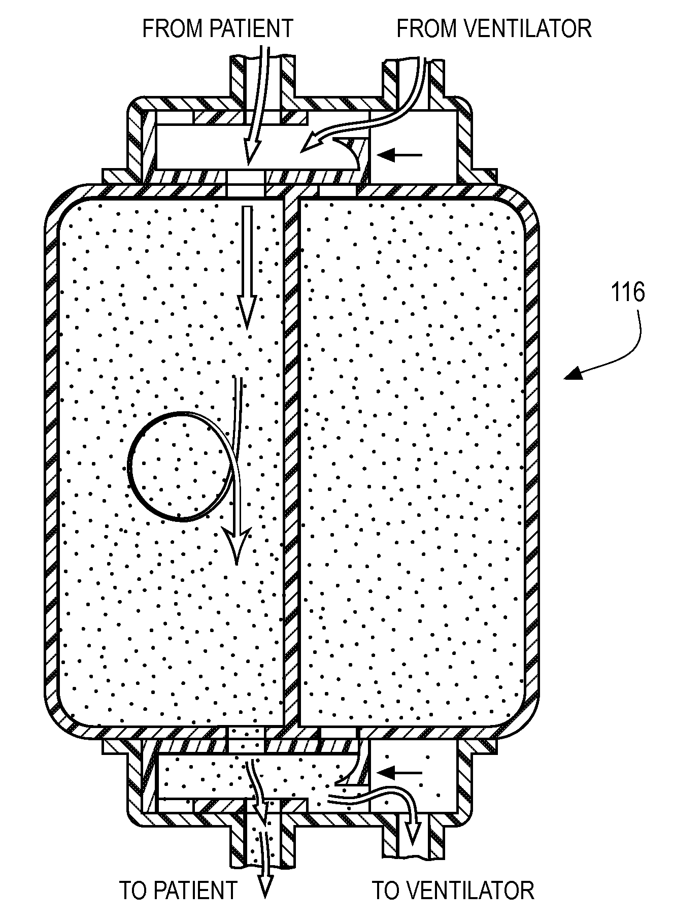 Inhaled anesthetic agent therapy and delivery system