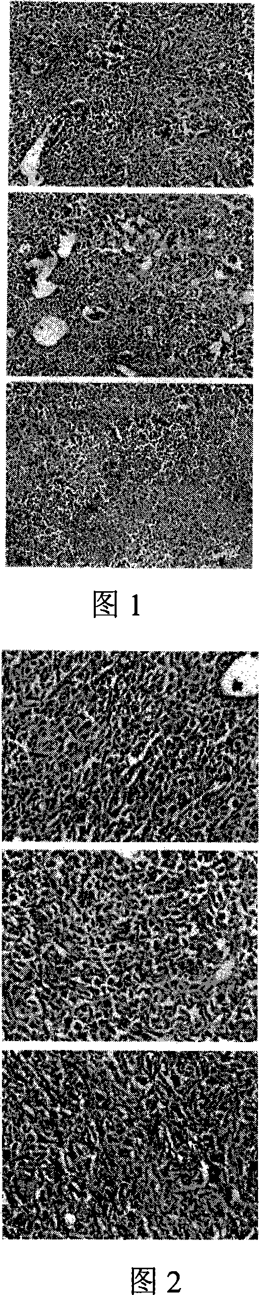 Inhibition lung cancer transfer and lung transfer tumor gene medicament