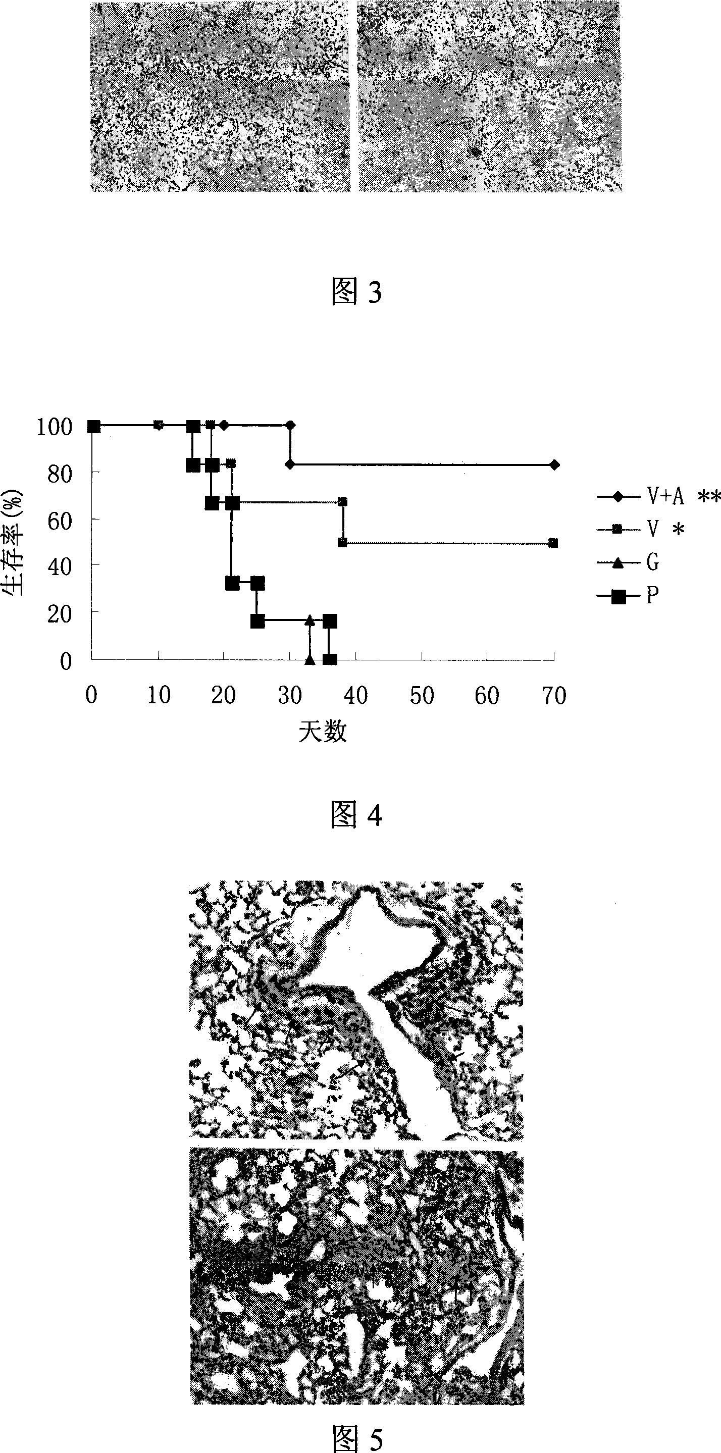 Inhibition lung cancer transfer and lung transfer tumor gene medicament