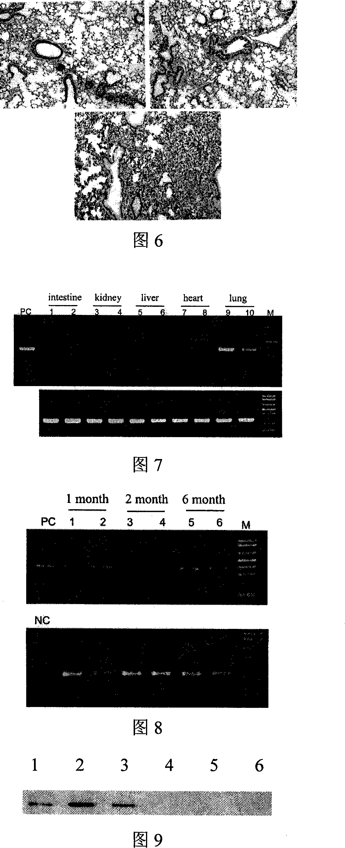 Inhibition lung cancer transfer and lung transfer tumor gene medicament