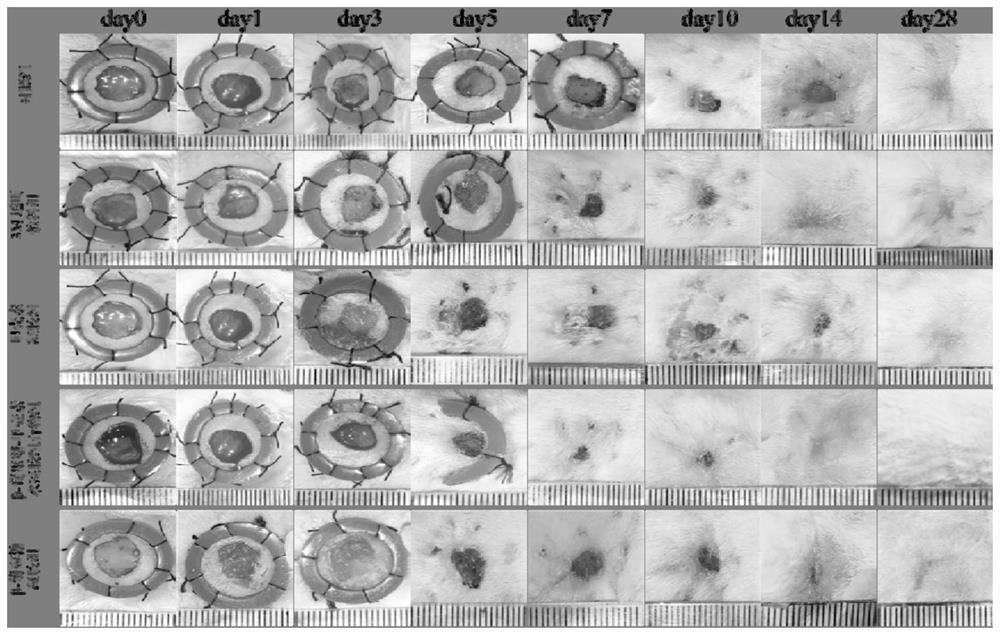 Hydrogel composition for inhibiting scar formation as well as preparation method and application thereof