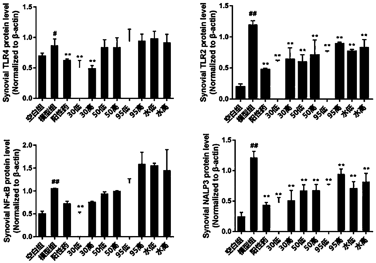 Medicine for resisting acute gouty arthritis and preparation method and application thereof