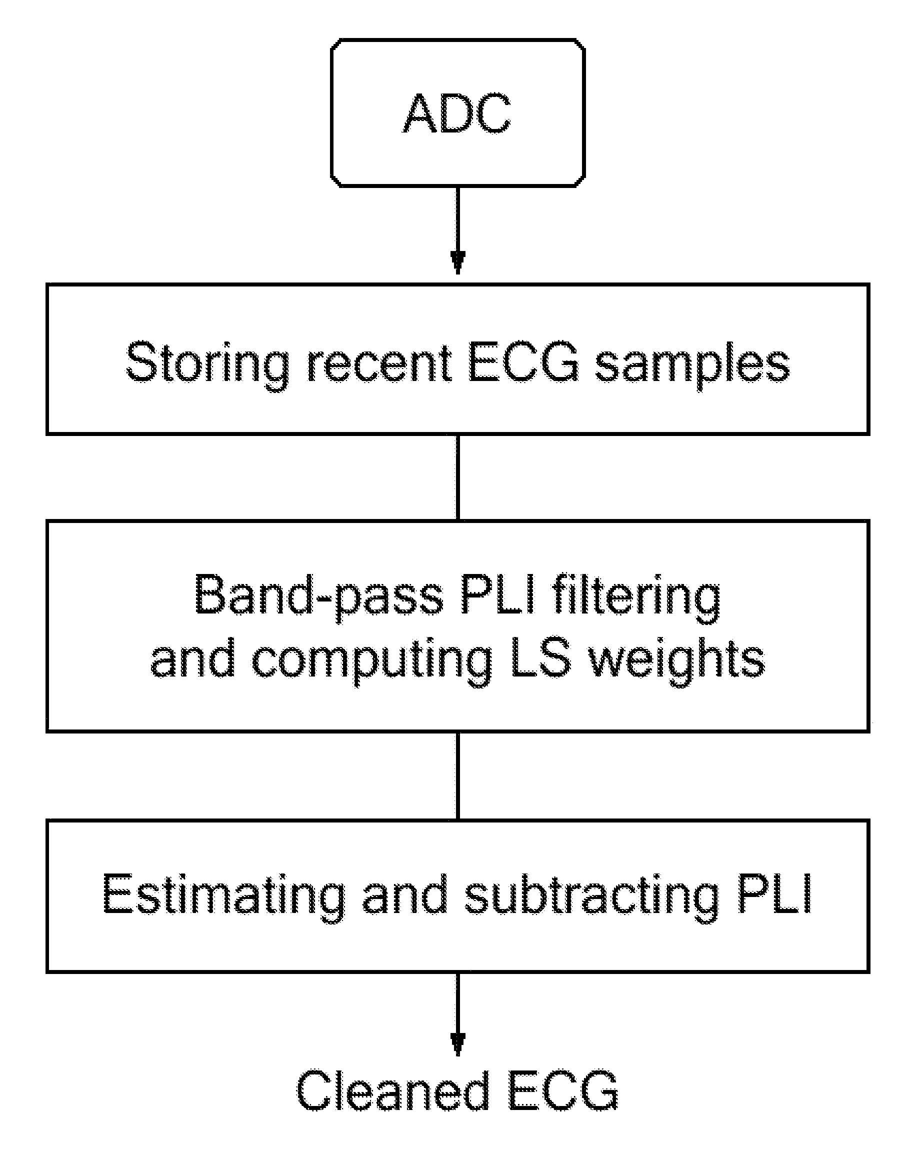 Technique for Real-Time Removal of Power Line Interference in ECG