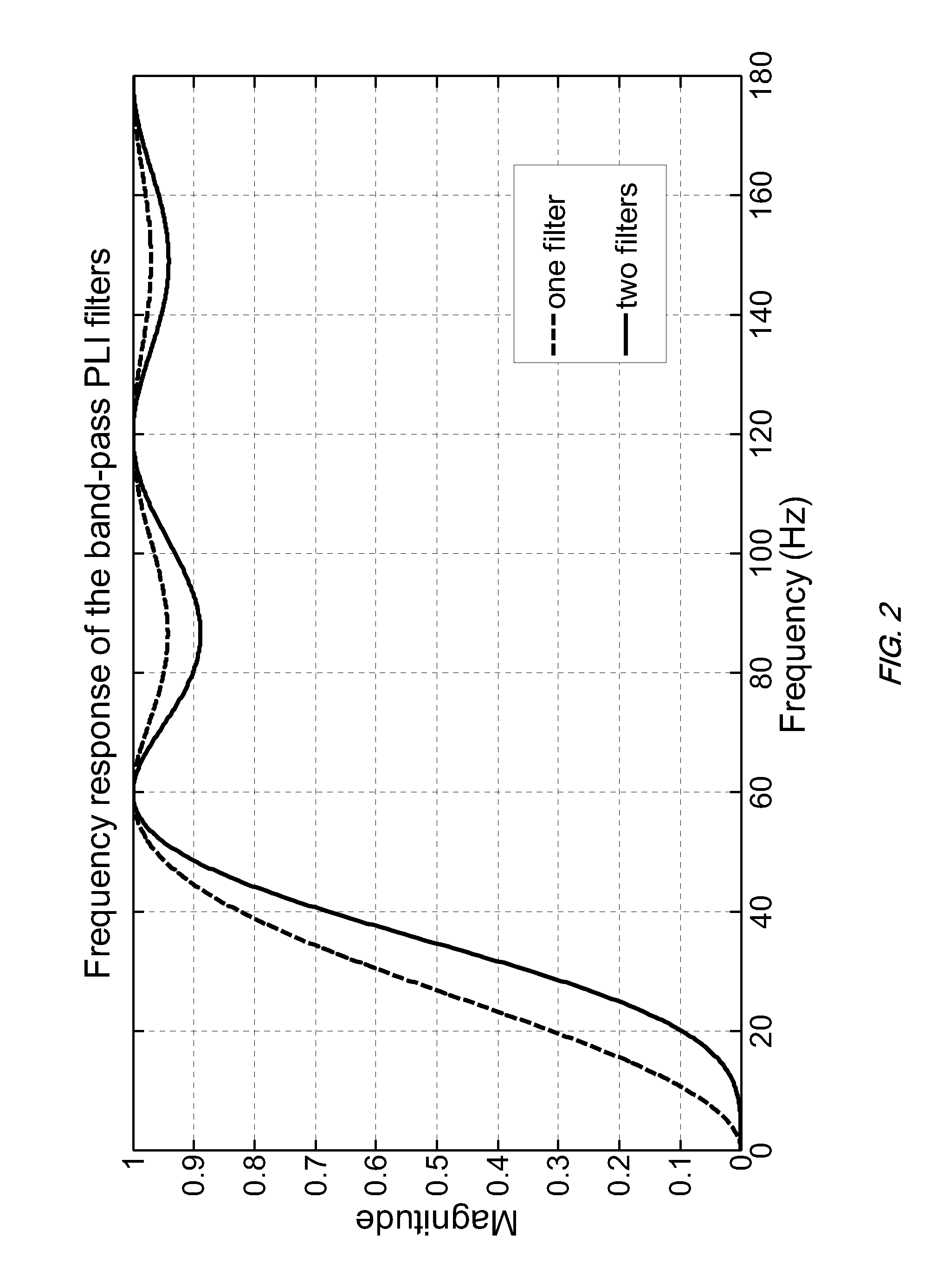 Technique for Real-Time Removal of Power Line Interference in ECG