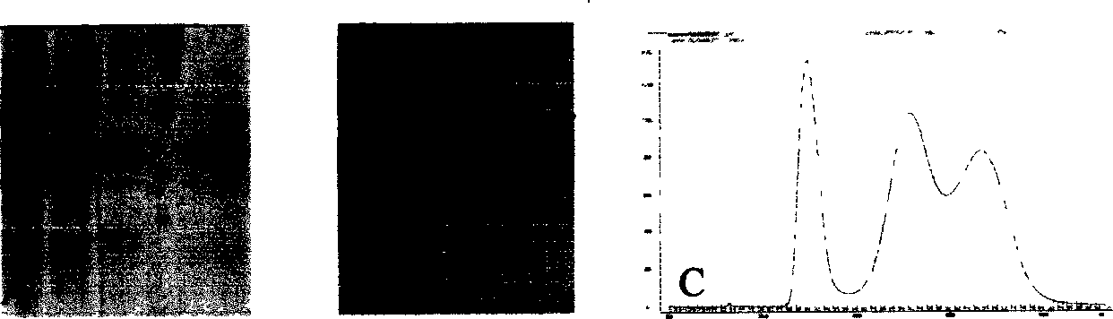 Recombination immune therapeutic protein and its expression method and application