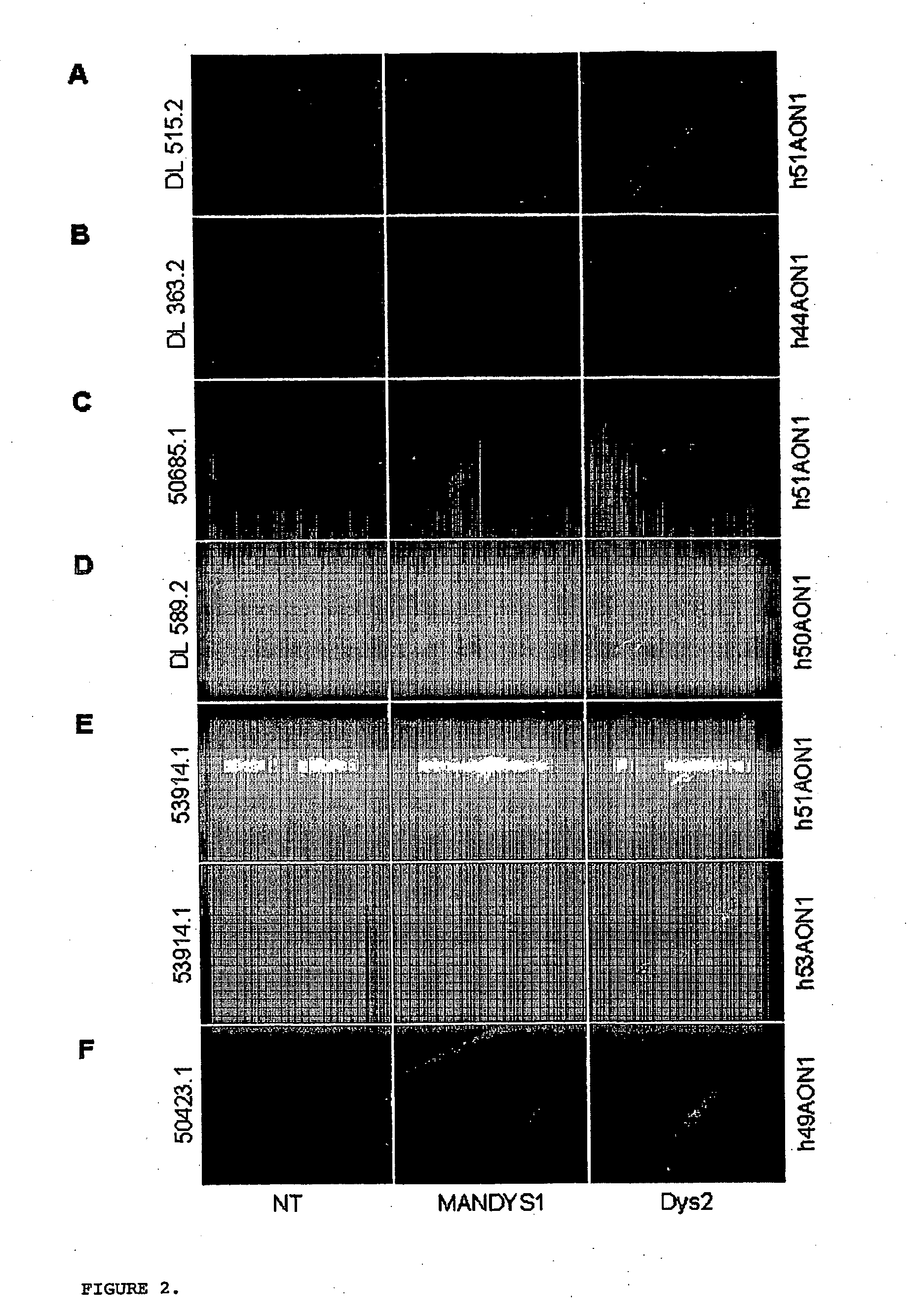 Modulation of exon recognition in pre-mRNA by interfering with the secondary RNA structure