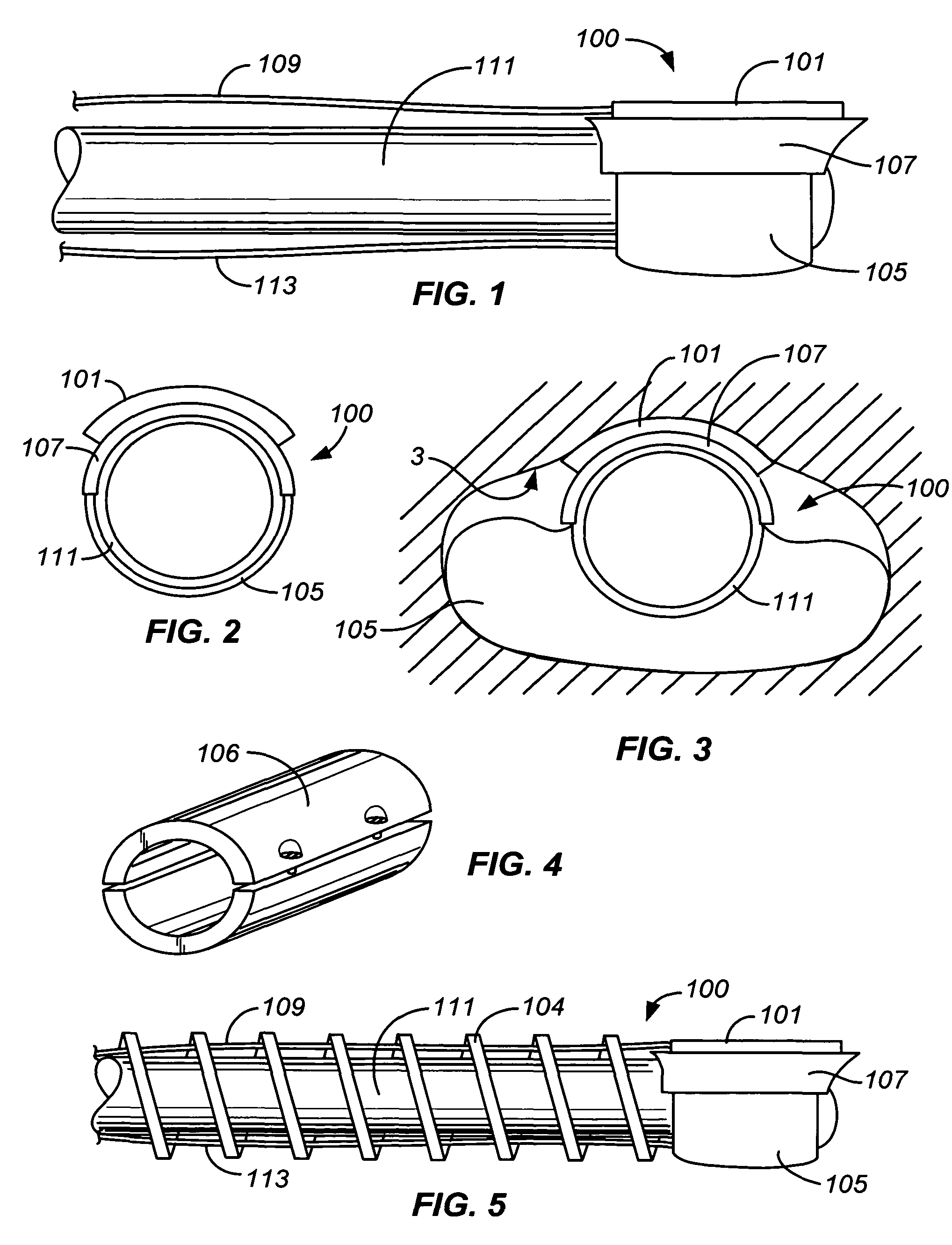 Precision ablating device