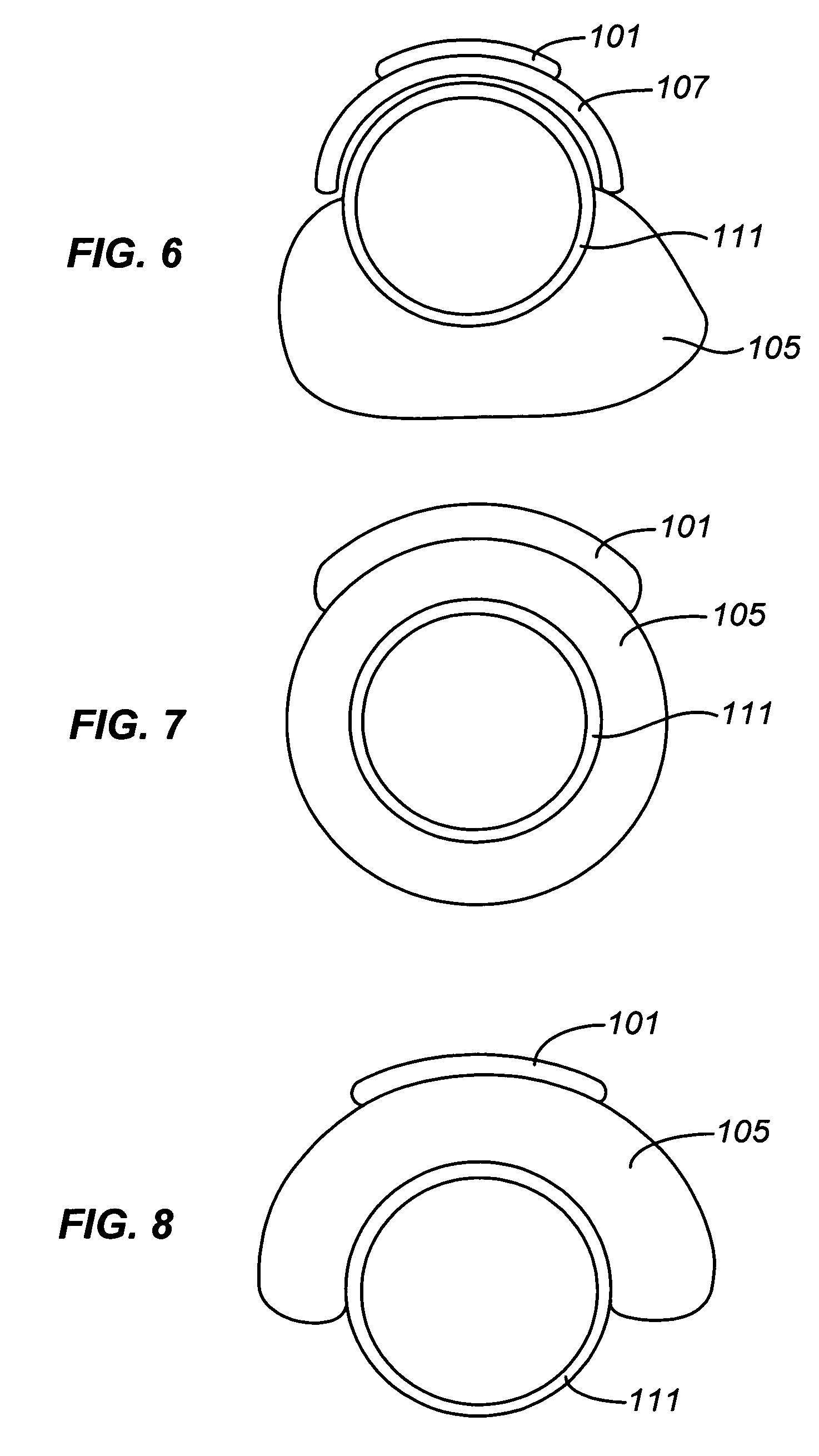 Precision ablating device