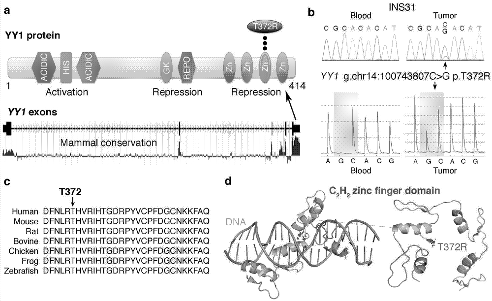 Pancreatic neuroendocrine tumor susceptibility gene site, and detection method and kit thereof