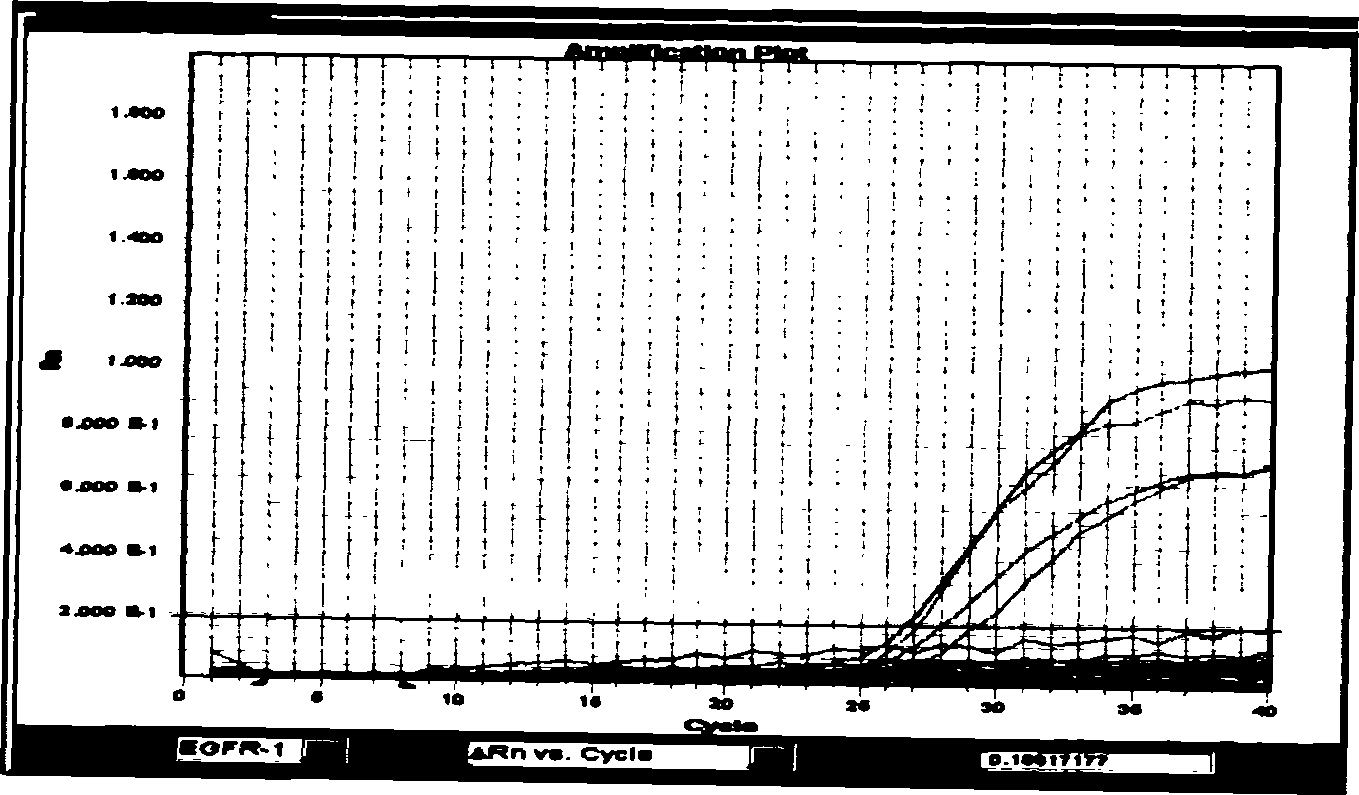 Fluorescent quantitative PCR reagent kit for detecting epidermal growth factor receptor gene point mutation