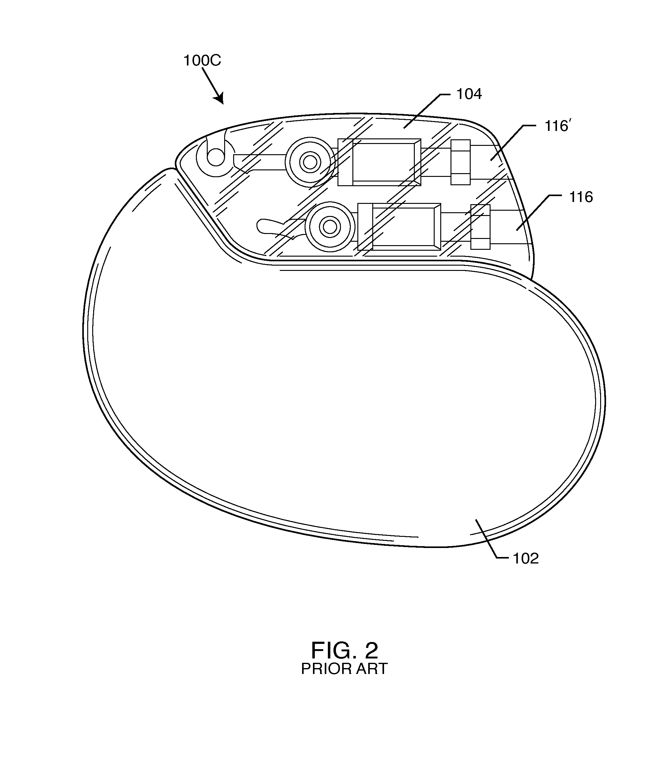 Capacitor and inductor elements physically disposed in series whose lumped parameters are electrically connected in parallel to form a bandstop filter