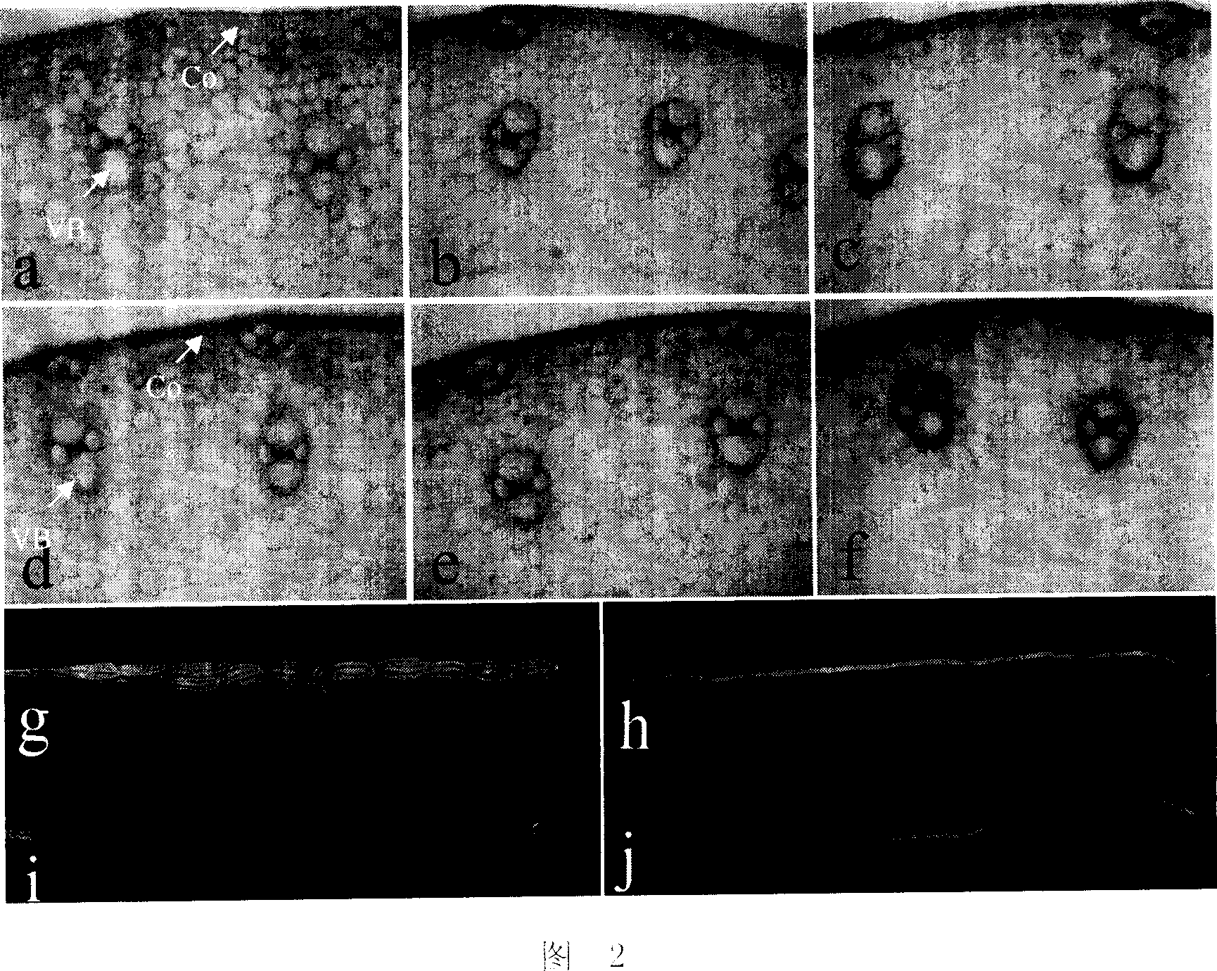 Lignin synthesis related protein and its coding gene and uses