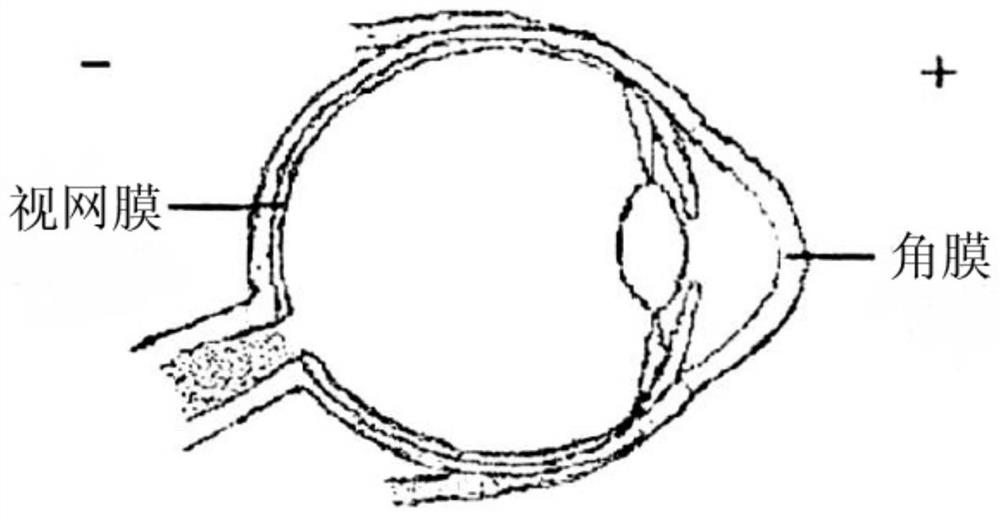 Head-mounted electro-oculogram control intelligent wheelchair and control method thereof