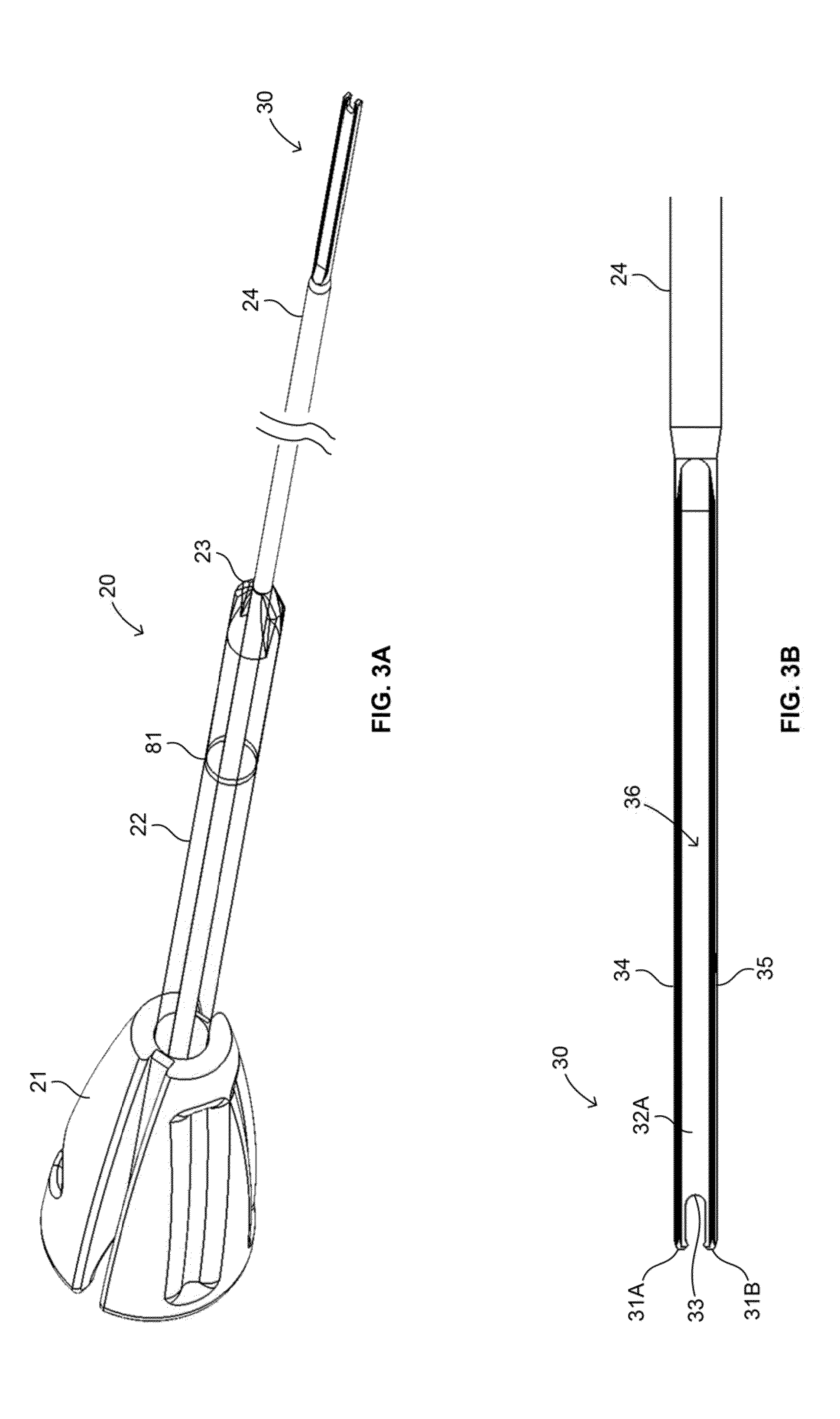 Soft tissue fixation devices and methods