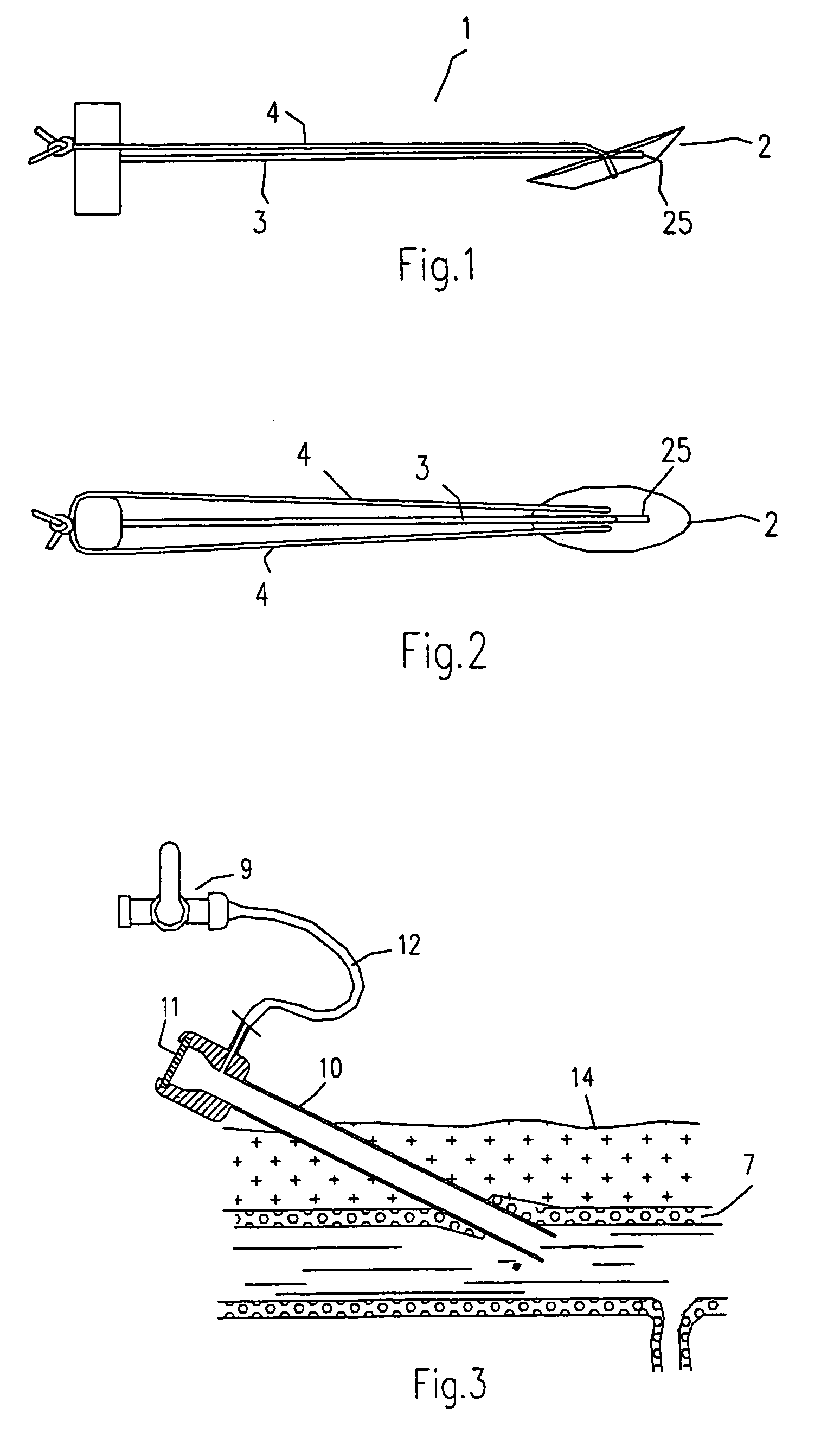 Technique to confirm correct positioning of arterial wall sealing device