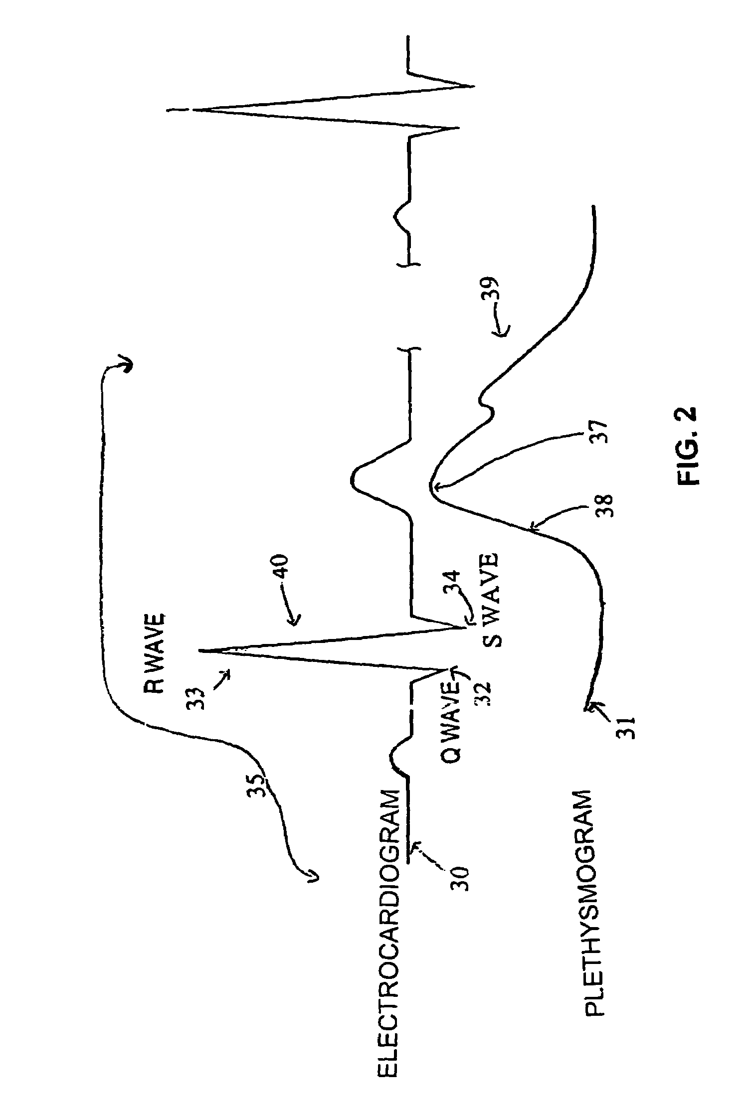 Systems and methods for providing sensor fusion