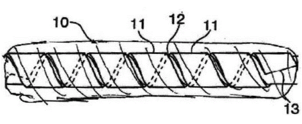 Helical hybrid stent