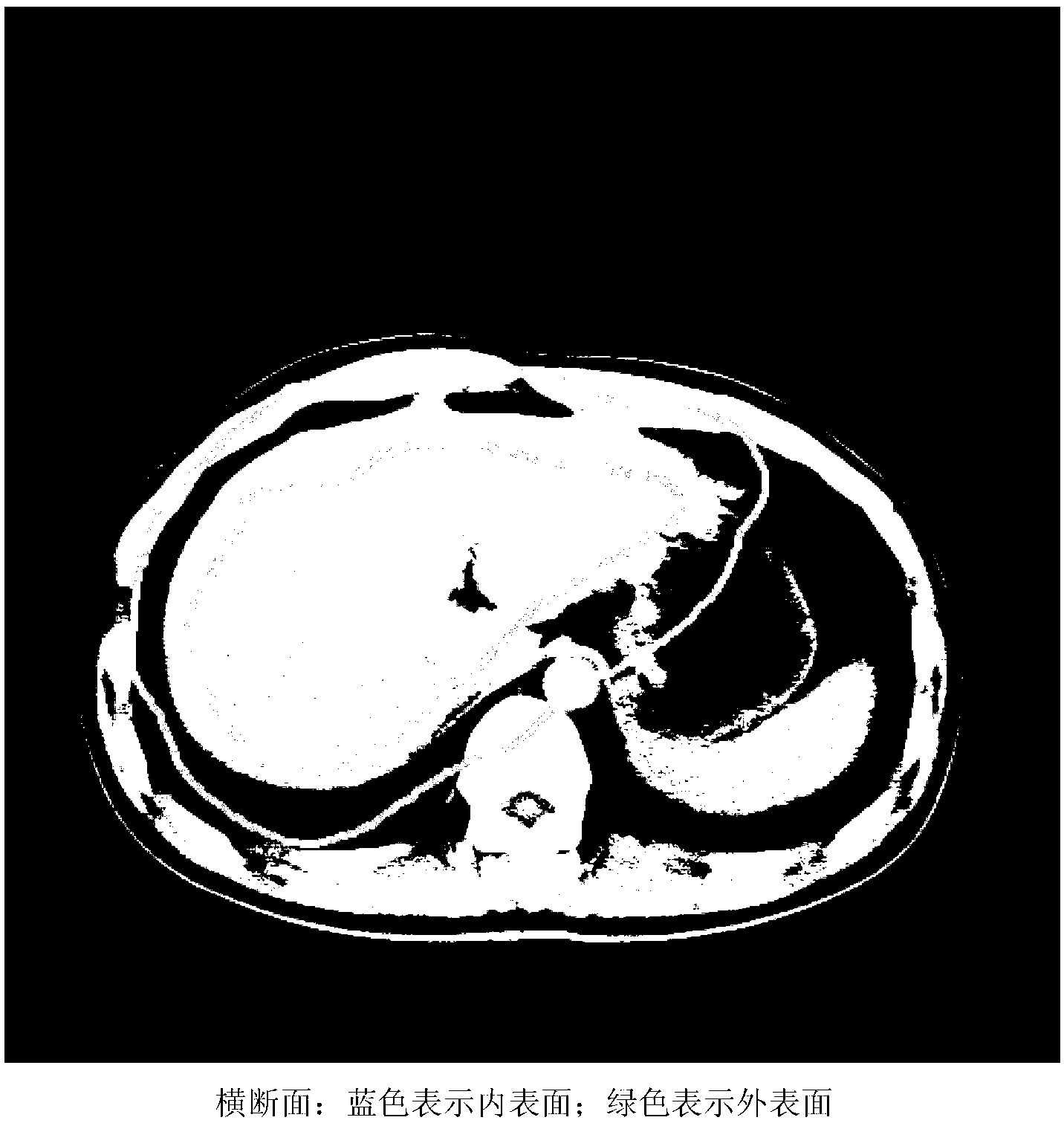 Medical image segmentation system and medical image segmentation method based on deformation surface models