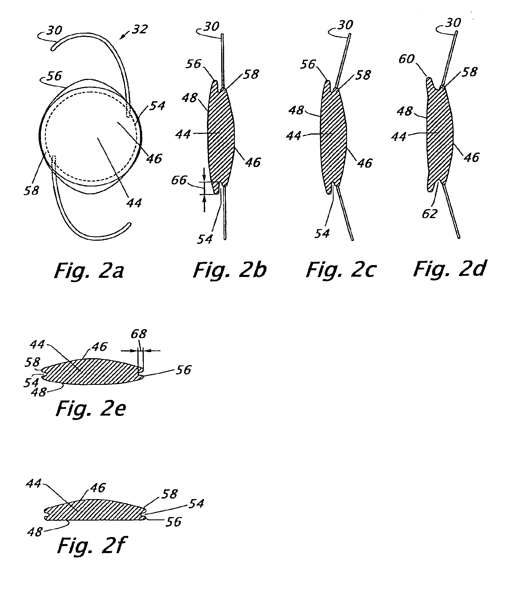 Intraocular lenses with a groove for closing the opening of the posterior capsule