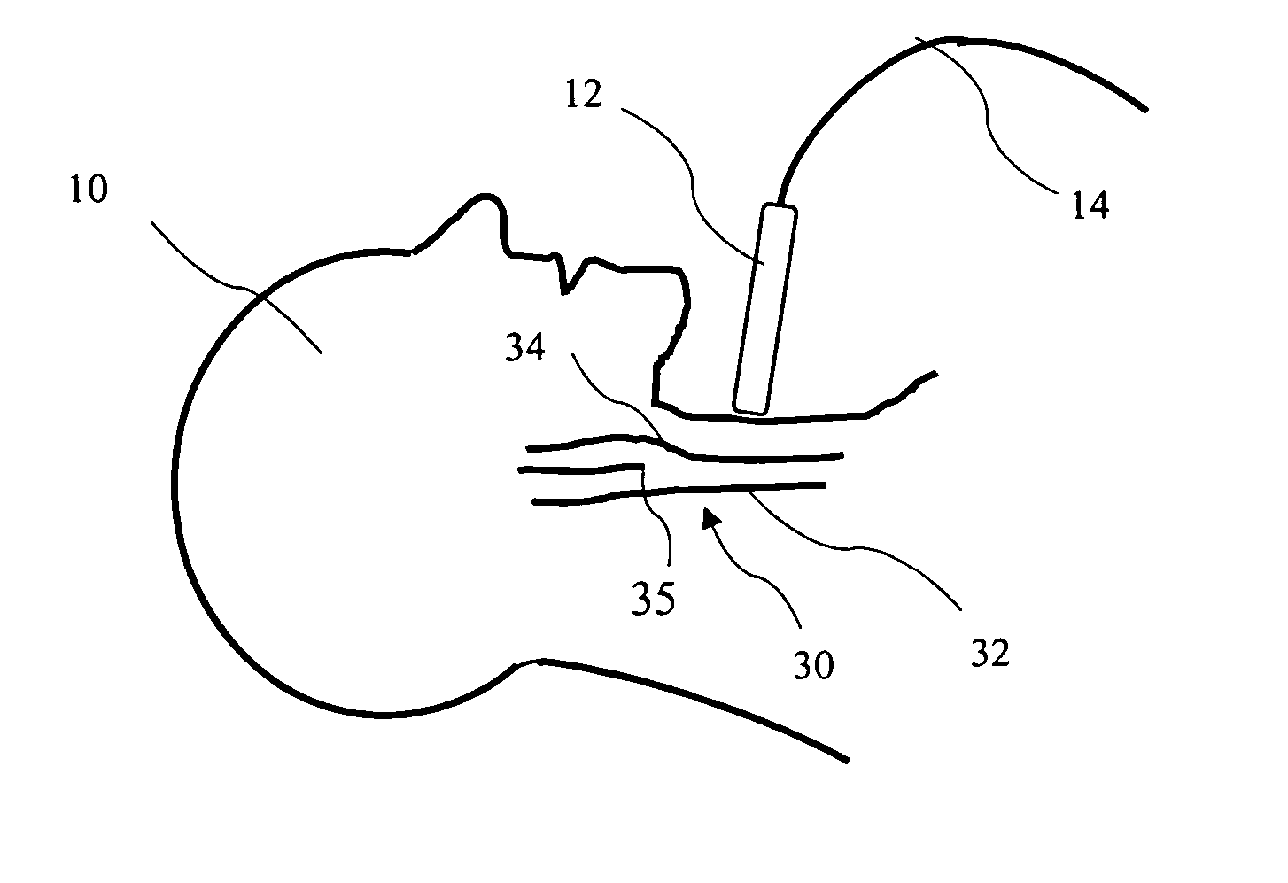 System and method for automatic determination of a Region Of Interest within an image