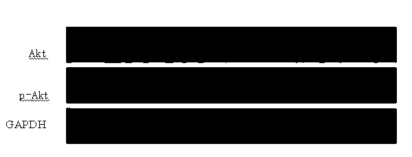 Application of two compositions in preparation of drug for combinedly treating diabetic nephropathy