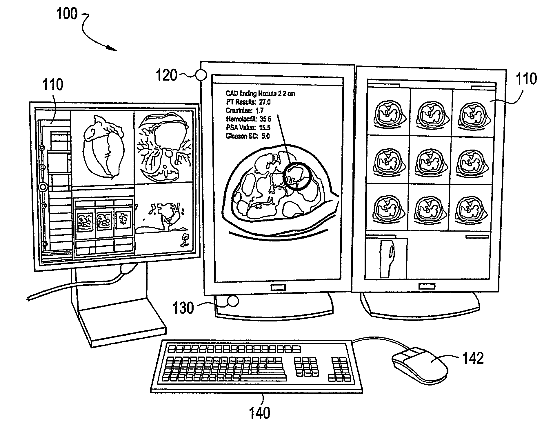 System and method for significant image selection using visual tracking