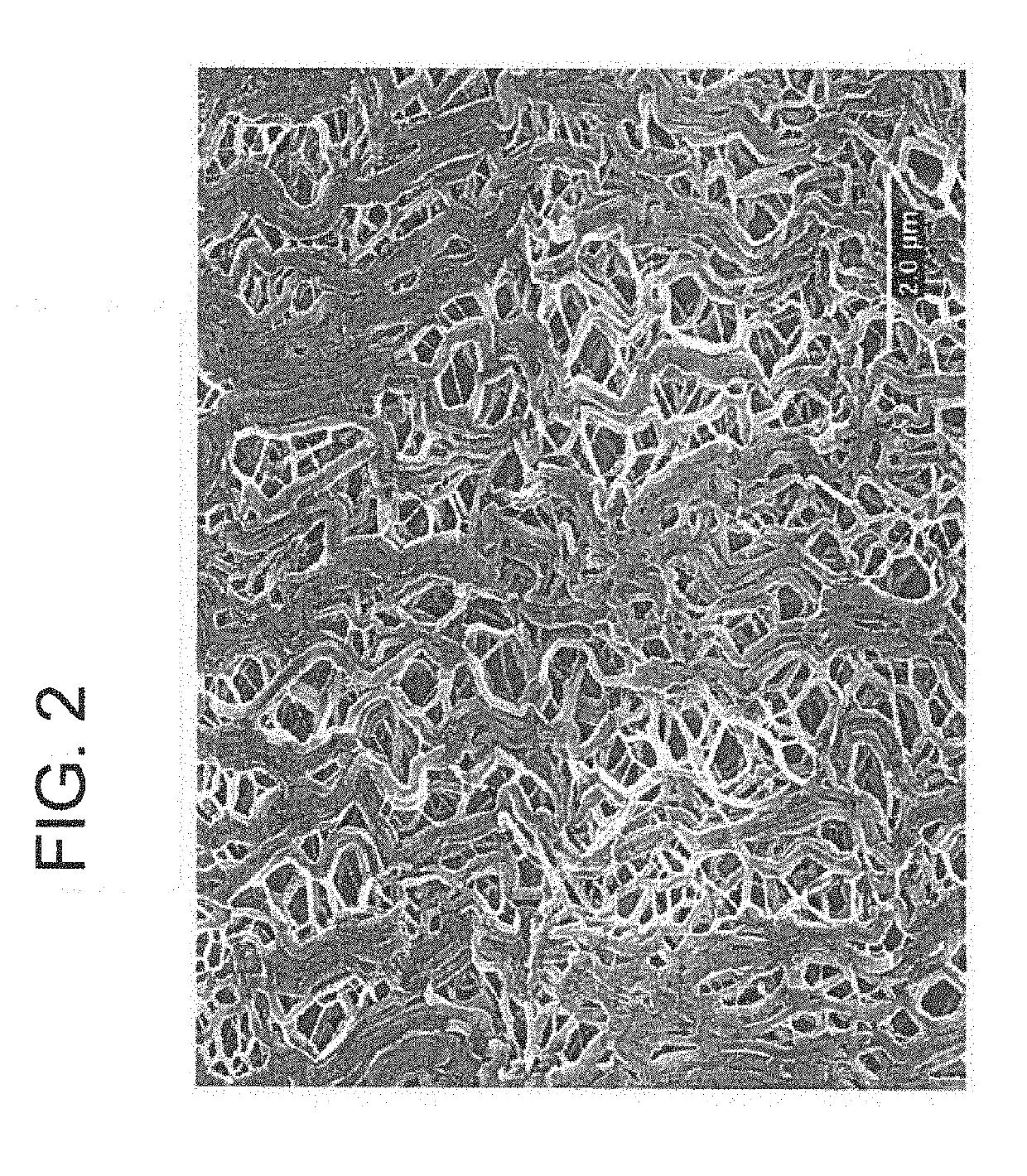 Medical balloon devices and methods