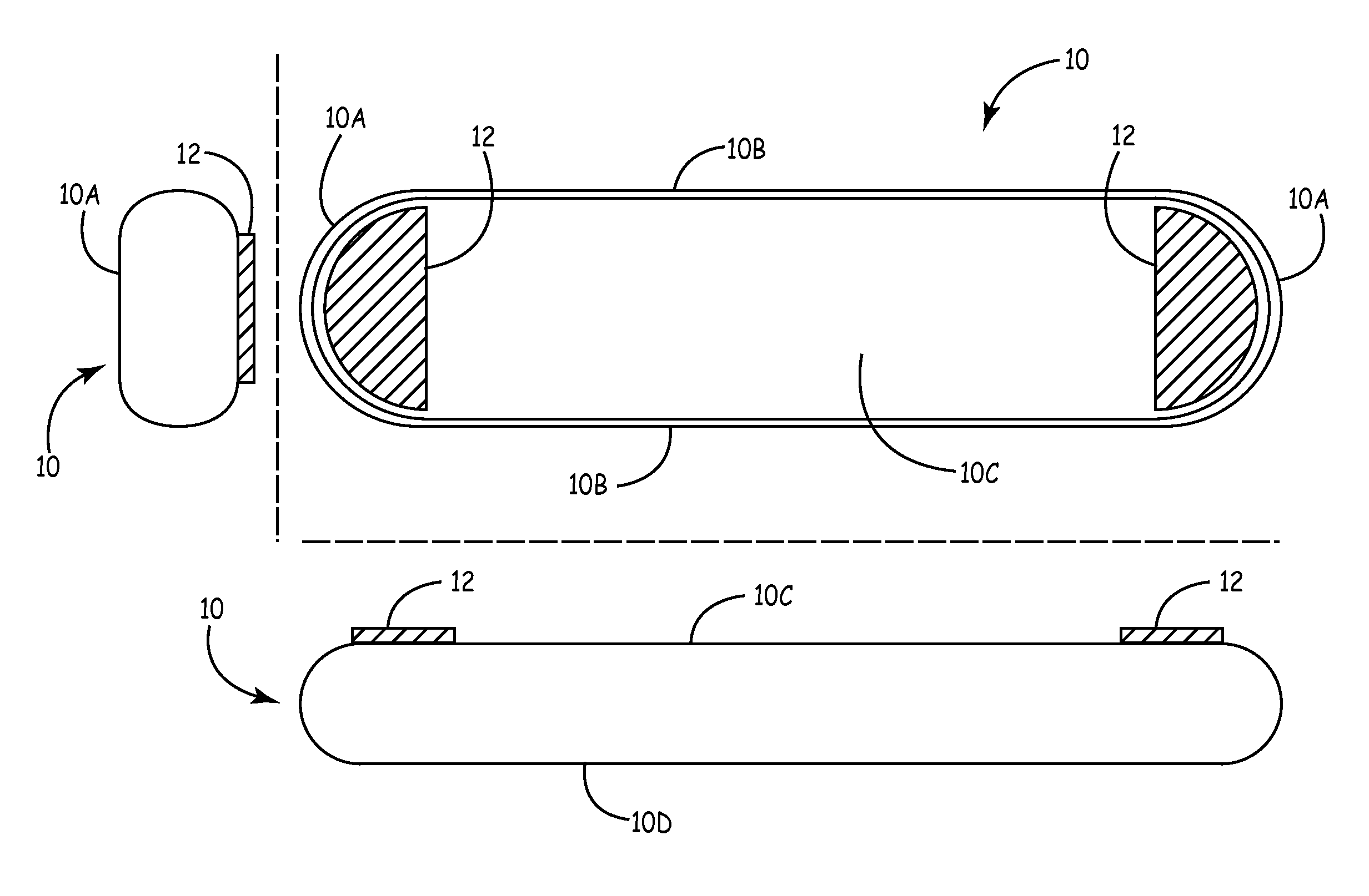 Electrode shapes and positions for reducing loss of contact in an implantable ECG recorder