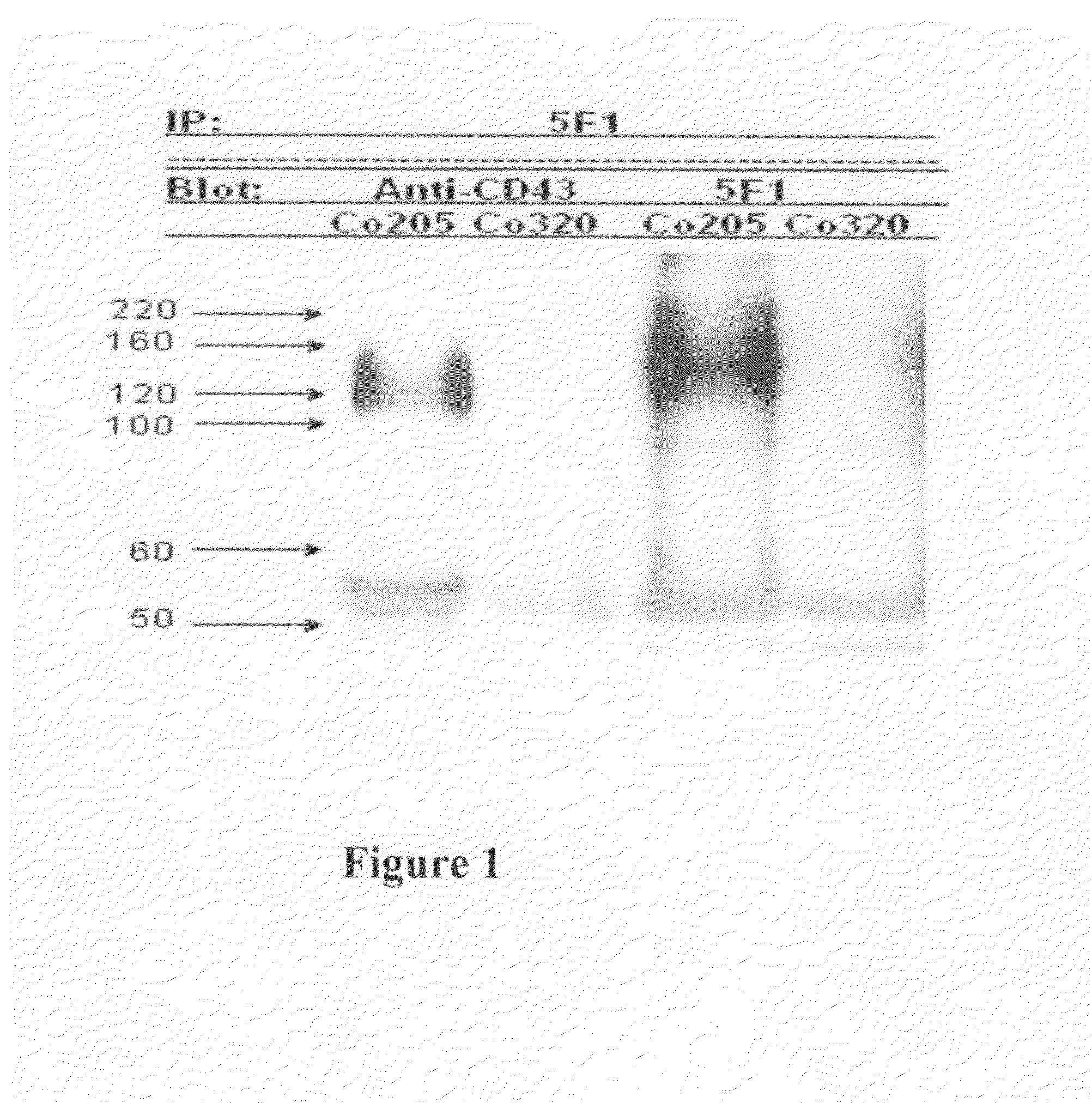 Antibodies recognizing a carbohydrate containing epitope on CD-43 and CEA expressed on cancer cells and methods using same